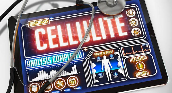 3 Steps to prevent and reduce Cellulite | Mr Vitamins