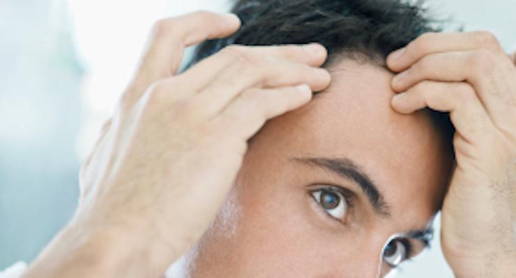 How do you stop Hair Loss and encourage Hair Growth?