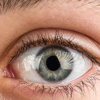 Introduction to Iridology