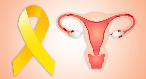8 Ways to address Endometriosis Naturally