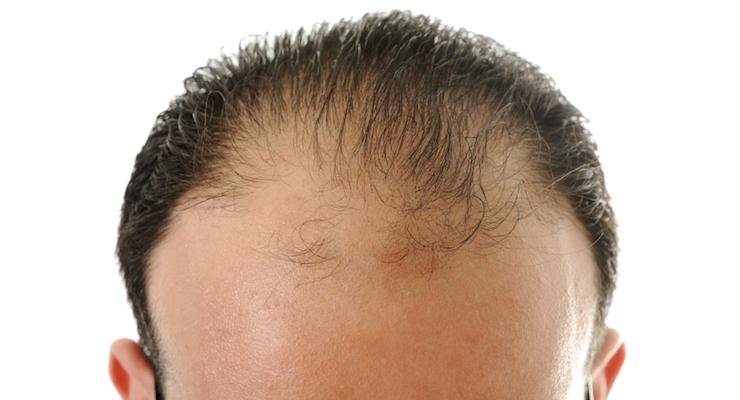 Healthy Hair Growth Fact Sheet