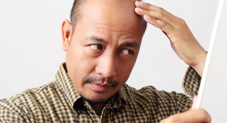 How can you support your hair growth naturally­?