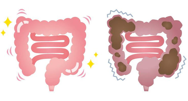 How to overcome bowel problems with Probiotics | Mr Vitamins
