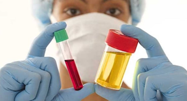 How Uric Acid in your blood can cause Gout – or something more serious! | Mr Vitamins