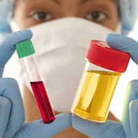 How Uric Acid may be damaging your body