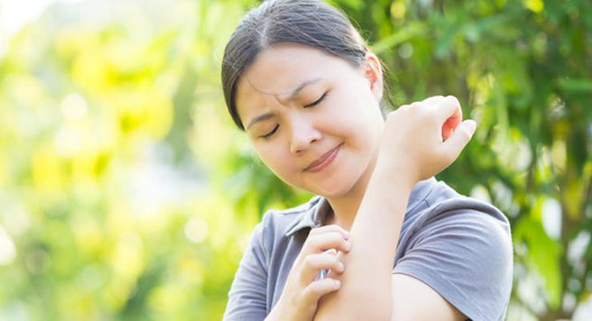 Prepare your skin for Winter and avoid Eczema | Mr Vitamins