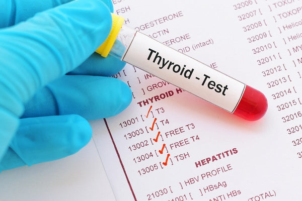 Thyroid function testing – should we be doing more? | Mr Vitamins
