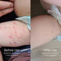 Pod Organics Blue Tansy Calming Baby Balm | Mr Vitamins